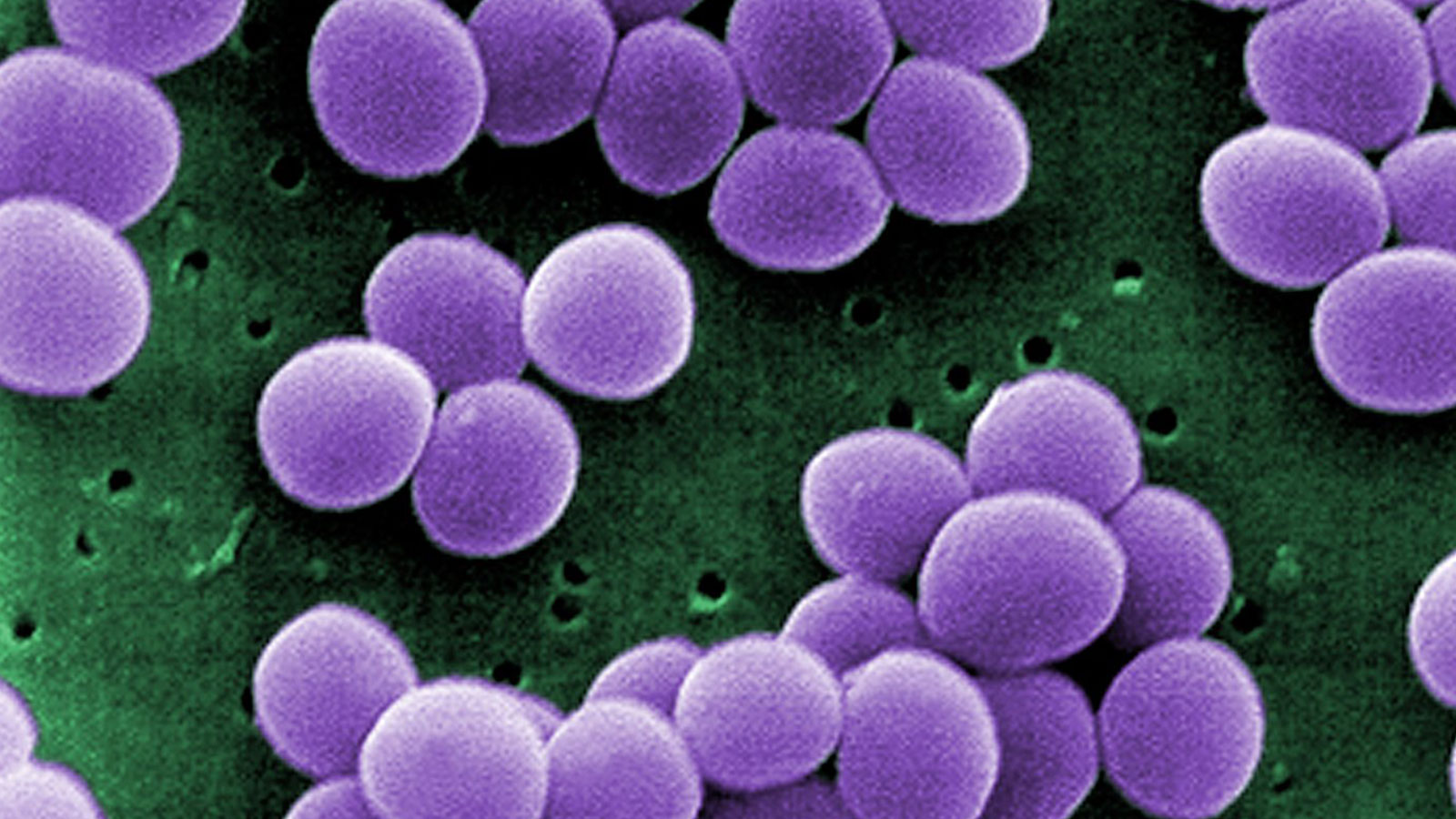 A microscopic view of Staphylococcus aureus